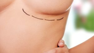 Breast augmentation surgery in India